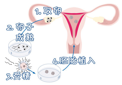 私人同性供卵代怀服务怎么选